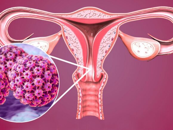 HPV e Câncer: A Importância da Vacinação contra o HPV